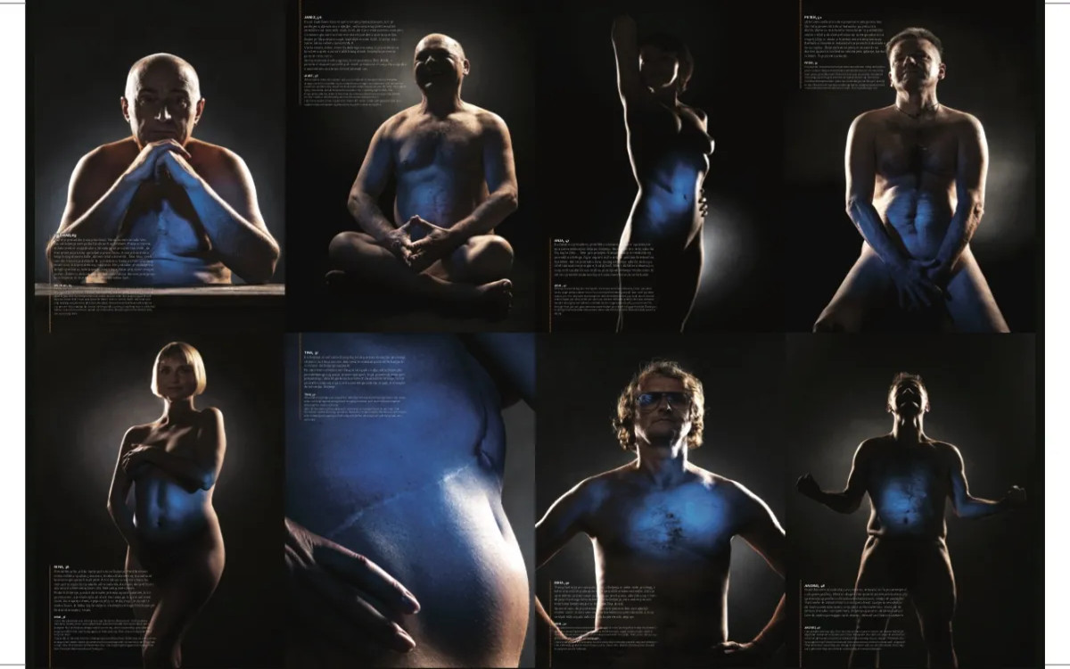 Razstava »Moja brazgotina, moje življenje«: Opravimo s tabuji