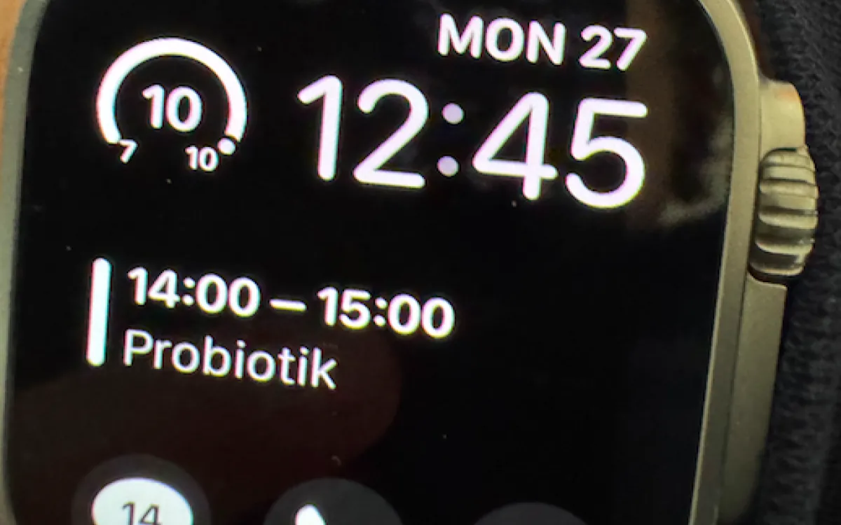 Ujetniki nadzornih ur